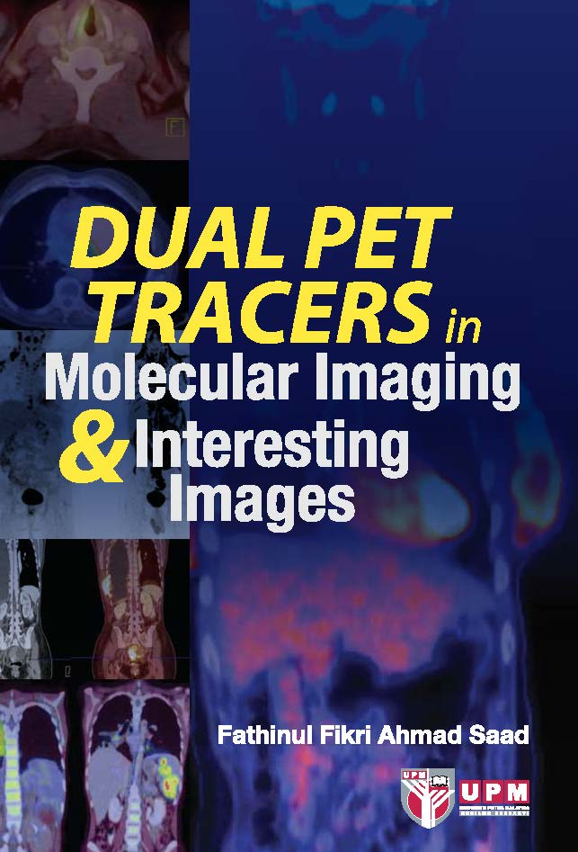 Dual Pet Tracers in Molecular Imaging & Interesting Images